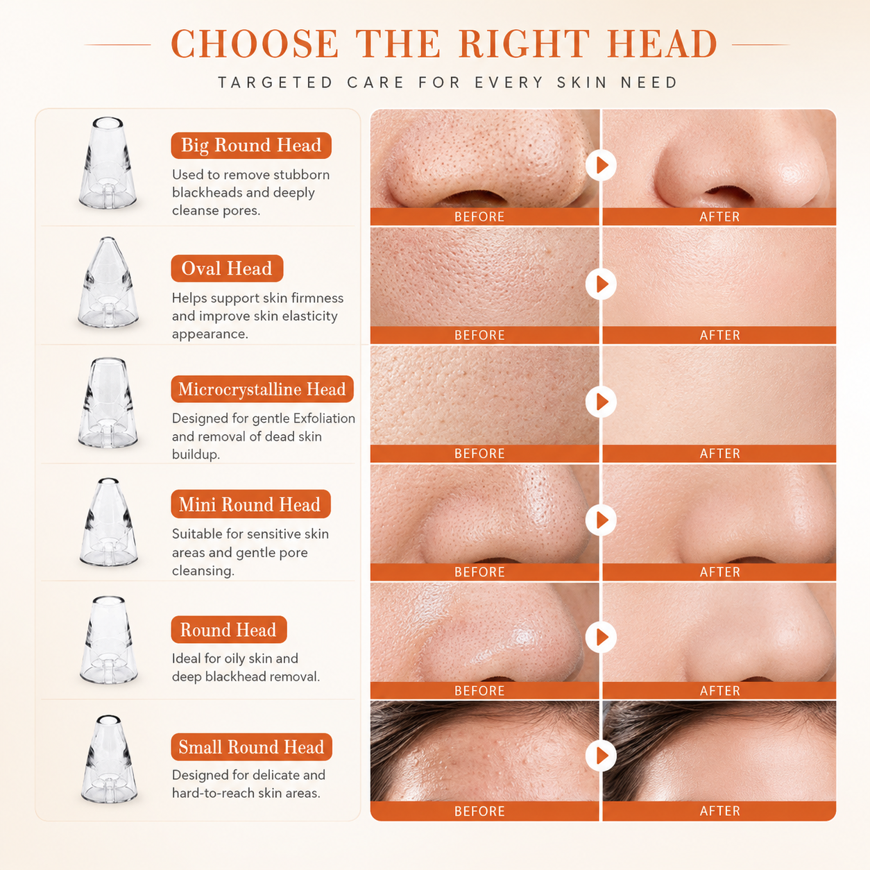 GlowSkin™ Portable Blackhead Remover ZAVION