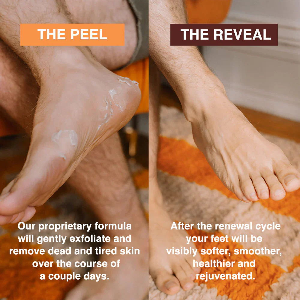 SeoulSkin Glycolic Acid Foot Peeling Mask (1 Pair), Korean Peeling & Exfoliating | Deep Exfoliation with Glycolic Acid, Removes Dead Skin, Cruelty-Free, Foot Peel Off Mask ZAVION