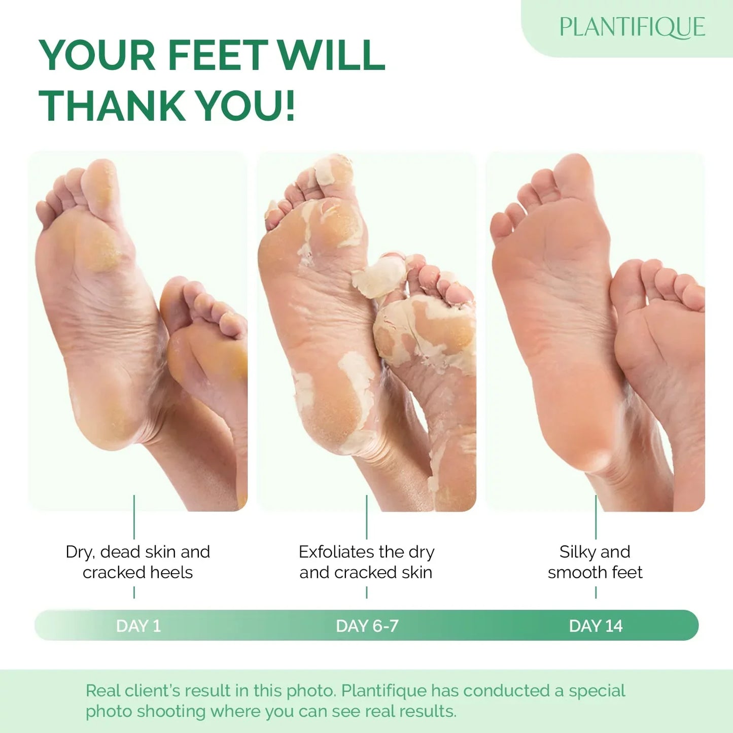 SeoulSkin Glycolic Acid Foot Peeling Mask (1 Pair), Korean Peeling & Exfoliating | Deep Exfoliation with Glycolic Acid, Removes Dead Skin, Cruelty-Free, Foot Peel Off Mask ZAVION