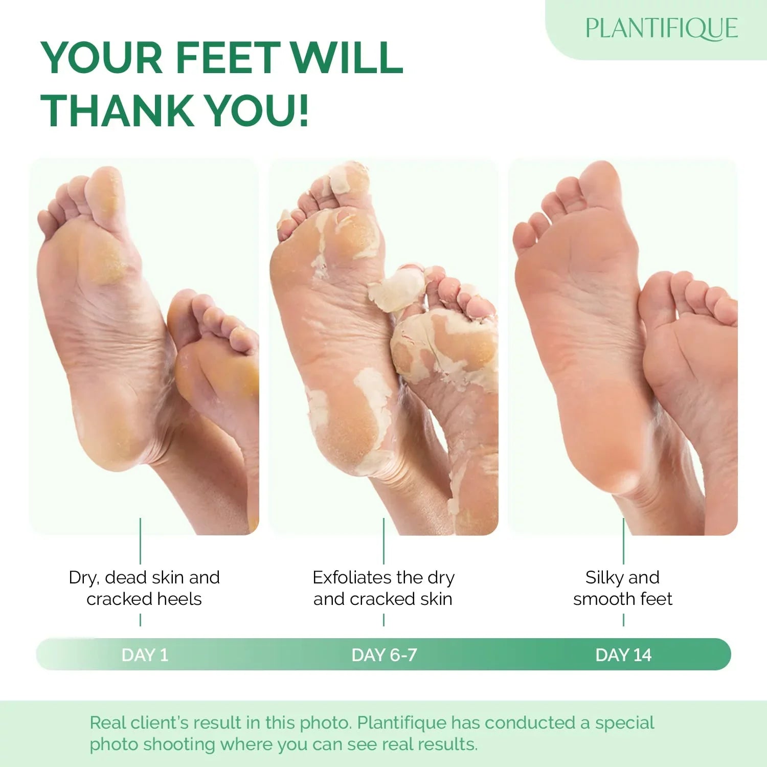 SeoulSkin Glycolic Acid Foot Peeling Mask (1 Pair), Korean Peeling & Exfoliating | Deep Exfoliation with Glycolic Acid, Removes Dead Skin, Cruelty-Free, Foot Peel Off Mask ZAVION